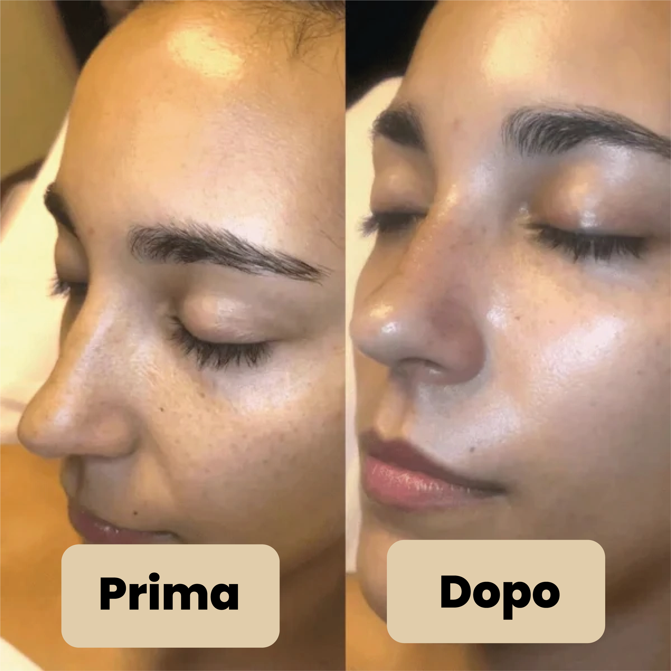 Vélia® | Peel Shot Coreano – Elimina le impurità e sublima la pelle