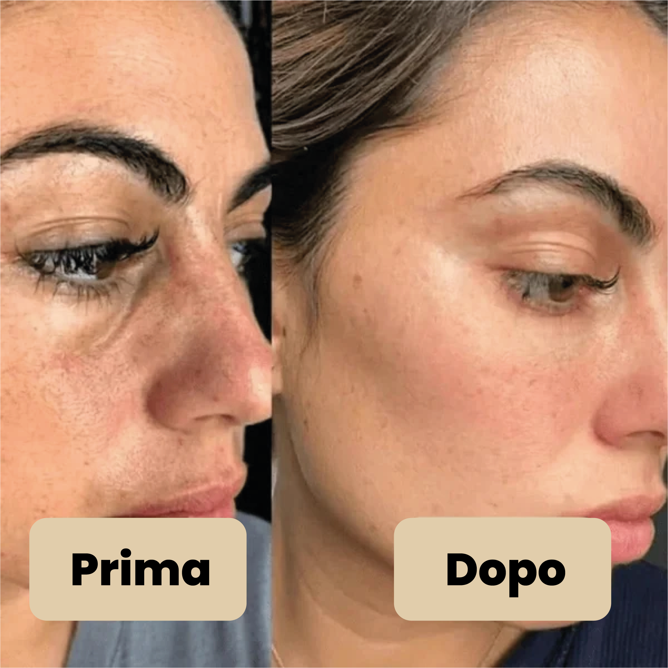 Vélia® | Peel Shot Coreano – Elimina le impurità e sublima la pelle