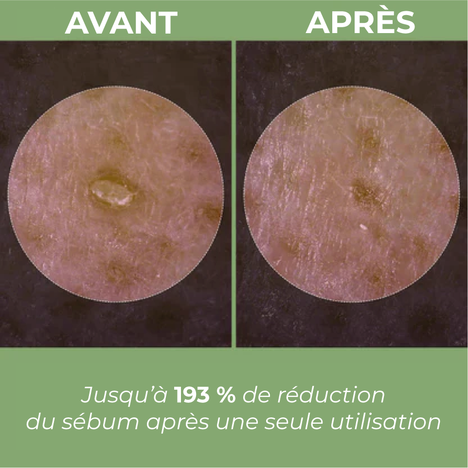 Sérum Exfoliant au Riz