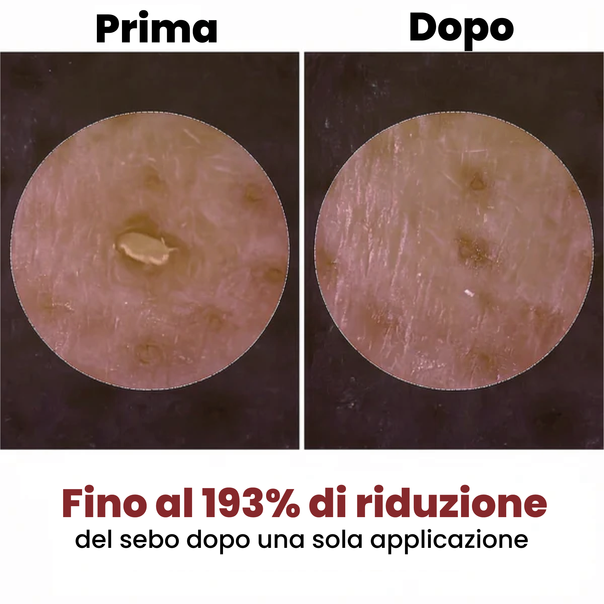 Vélia® | Peel Shot Coreano – Elimina le impurità e sublima la pelle