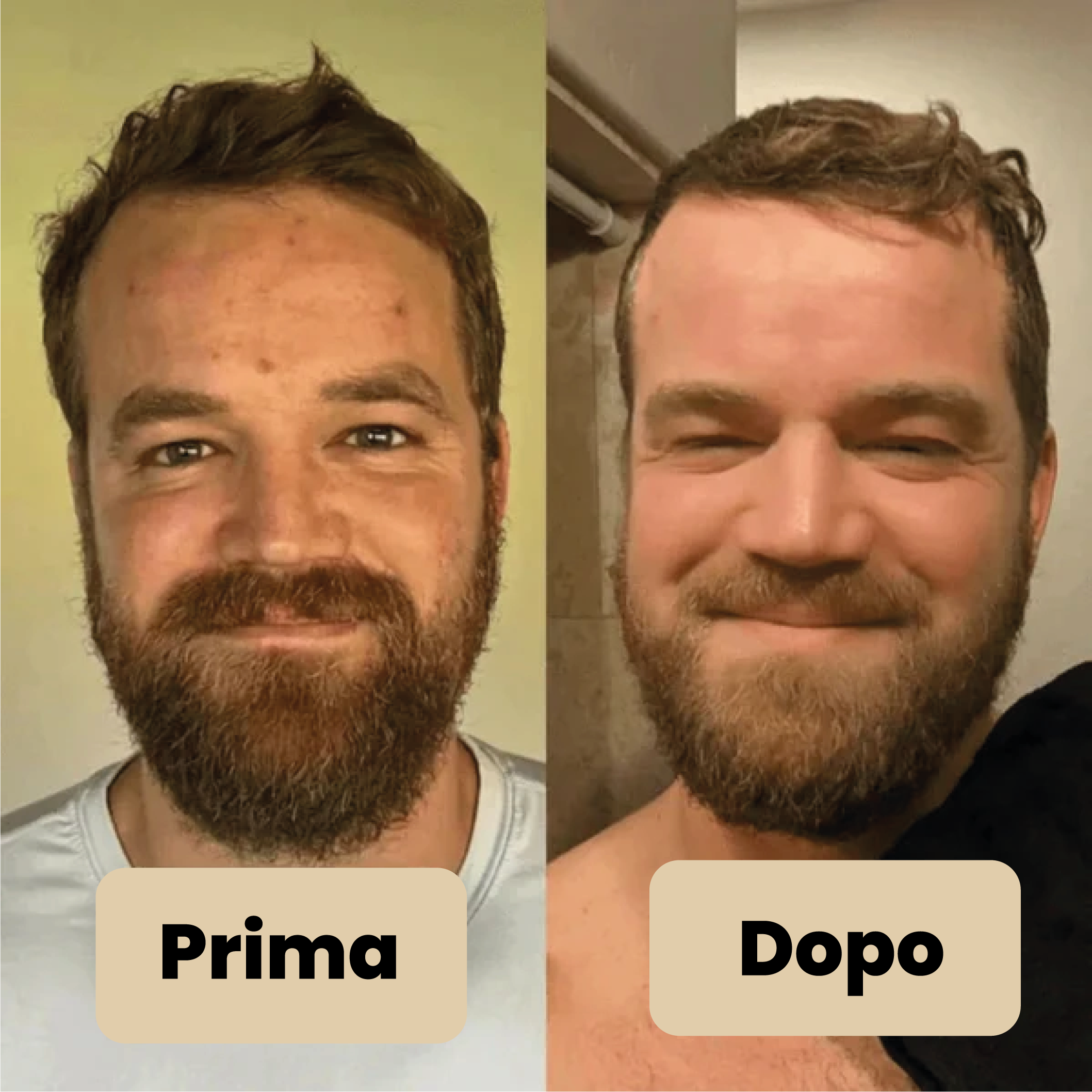 Vélia® | Korean Peel Shot – Elimina le impurità e sublima la pelle