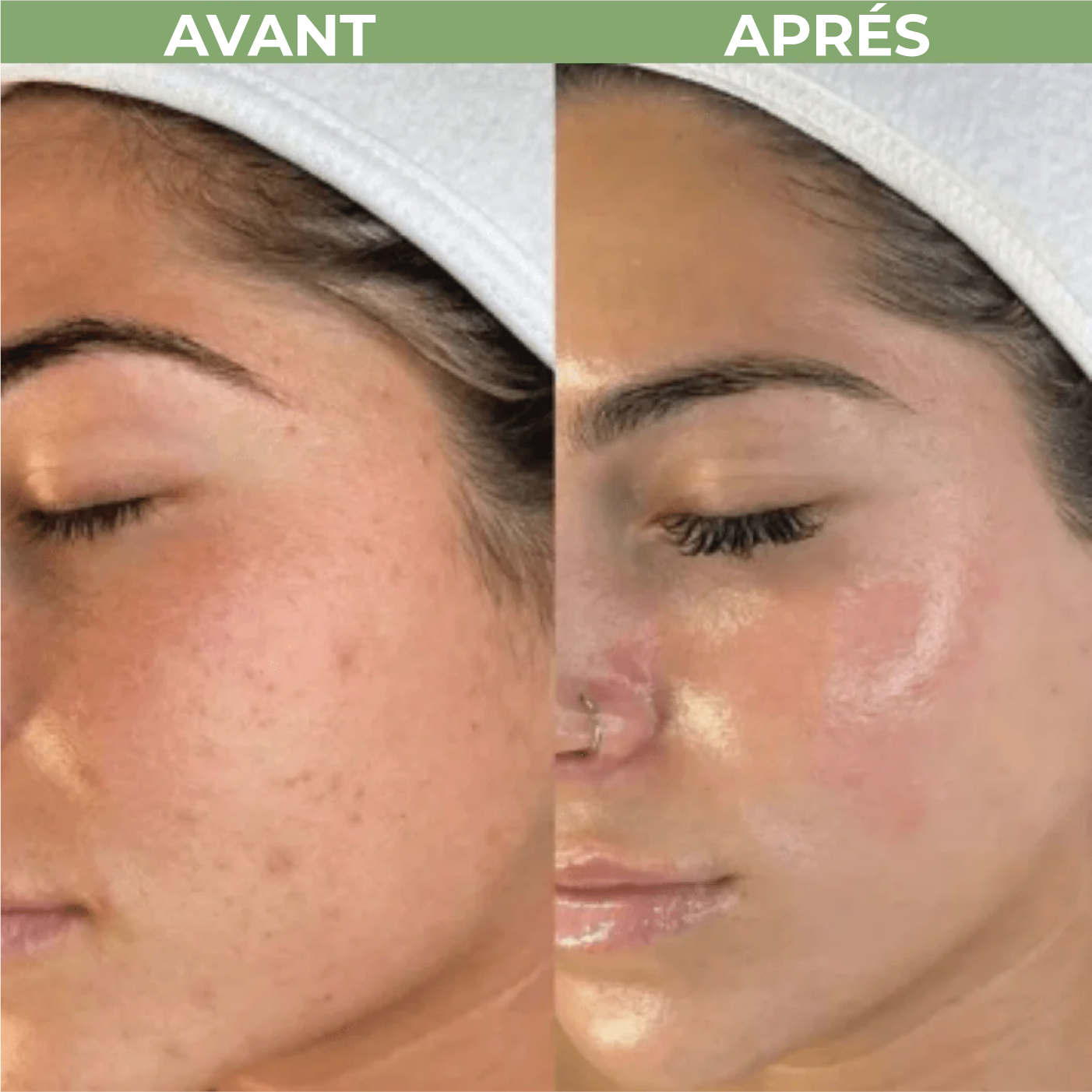 Sérum Exfoliant au Riz