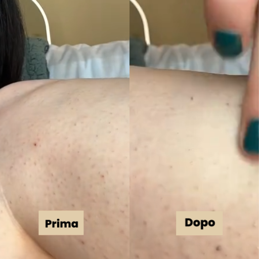 Vélia® | Peel Shot Coreano – Elimina le impurità e sublima la pelle